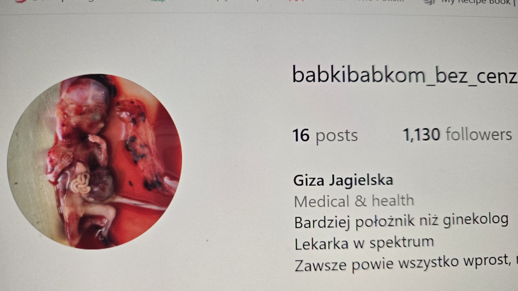 Babki-babkom - Rozkawałkowane dziecko